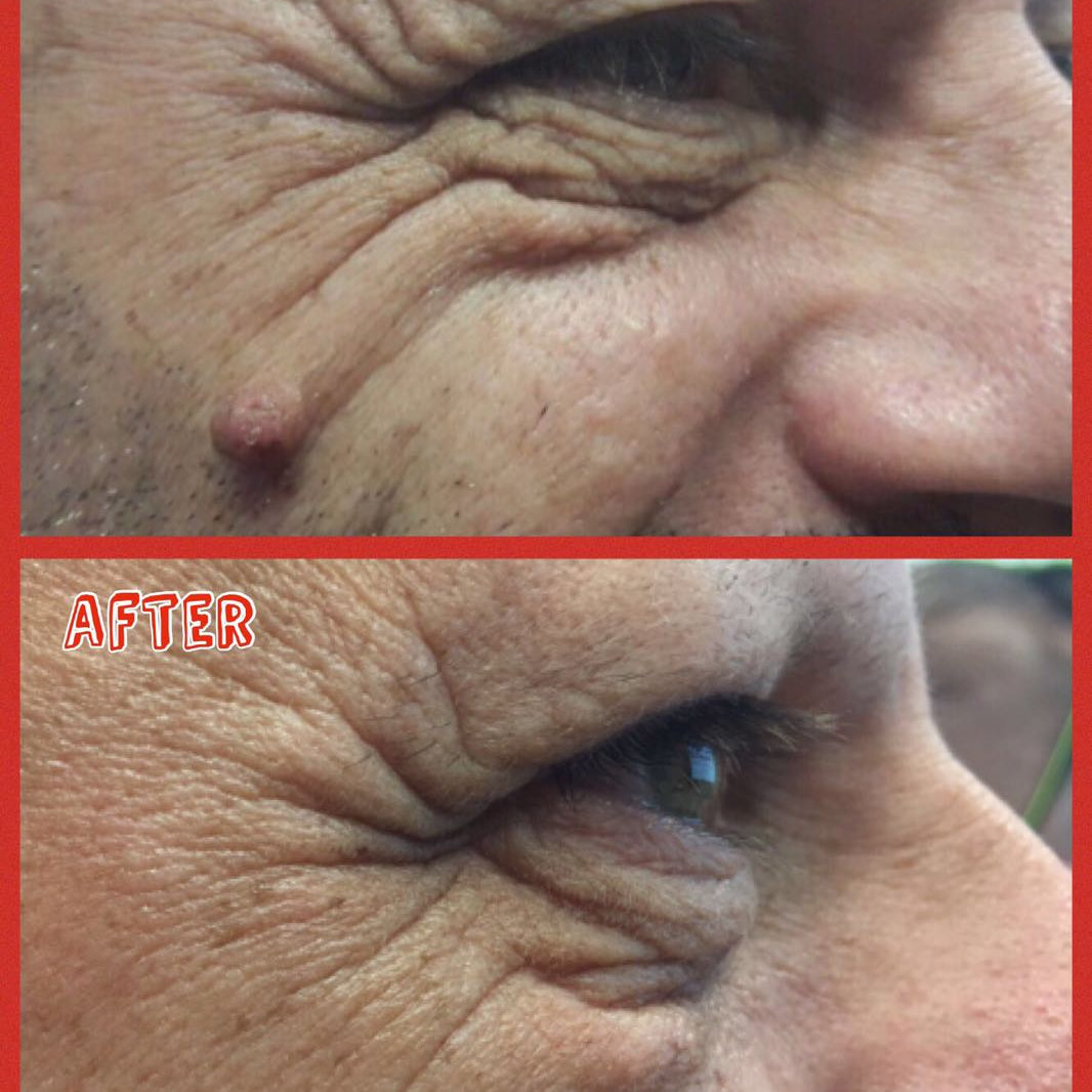 Wrinkle-reducing effect