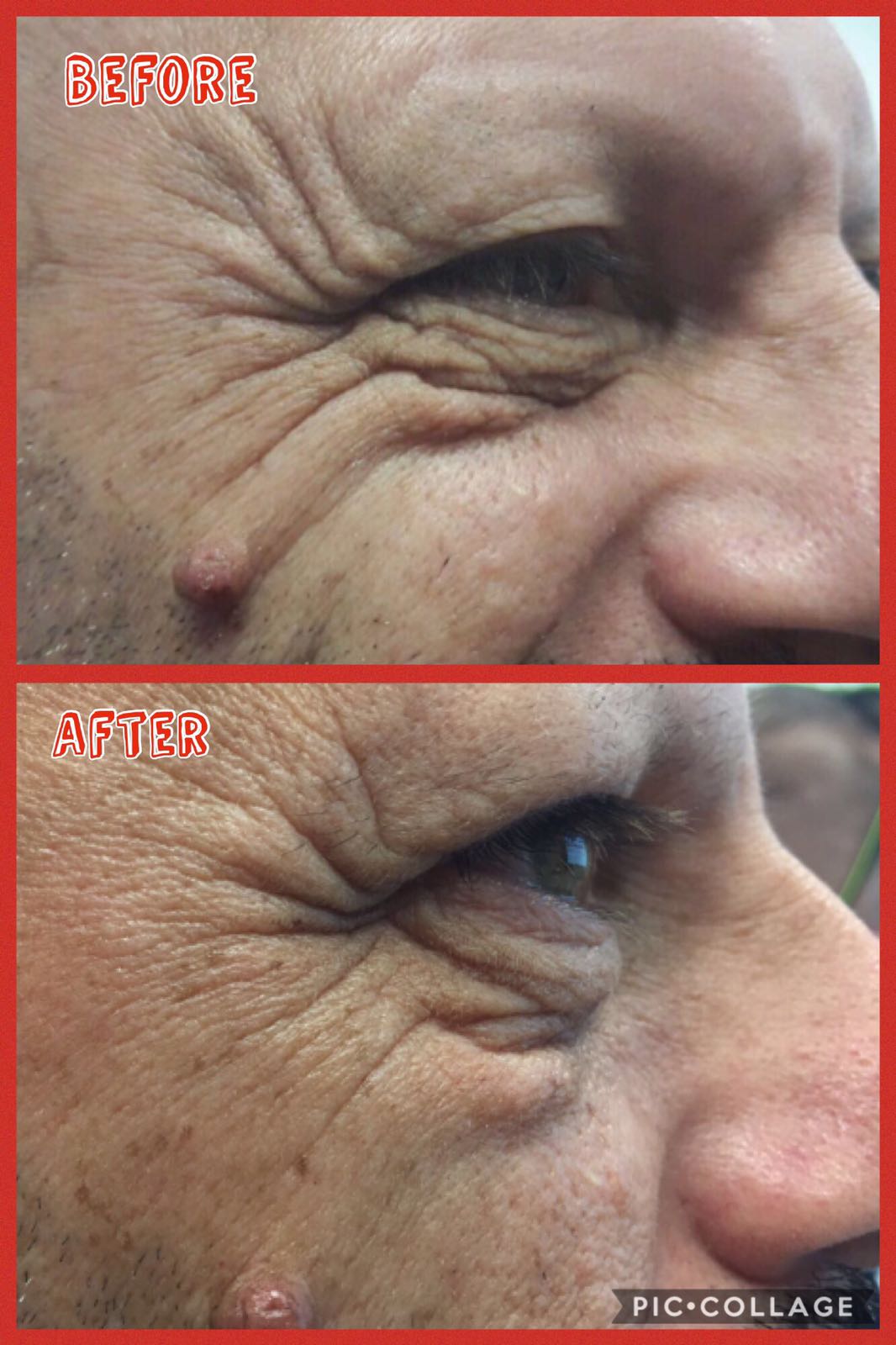 Wrinkle-reducing effect