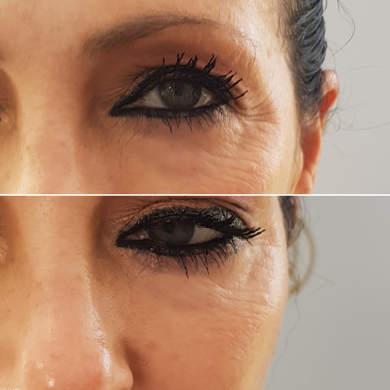 Wrinkle-reducing effect