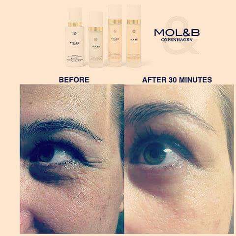 Wrinkle-reducing effect