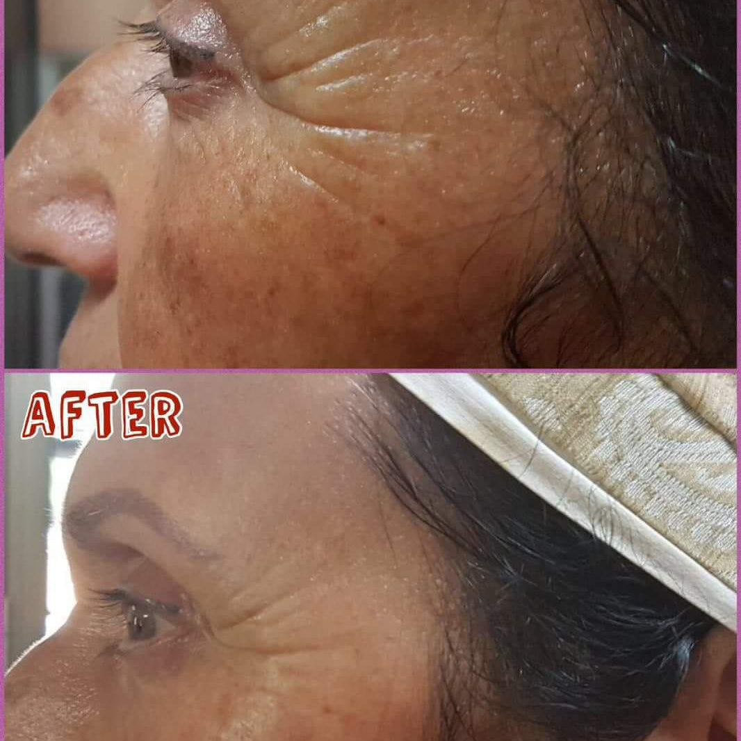 Wrinkle-reducing effect