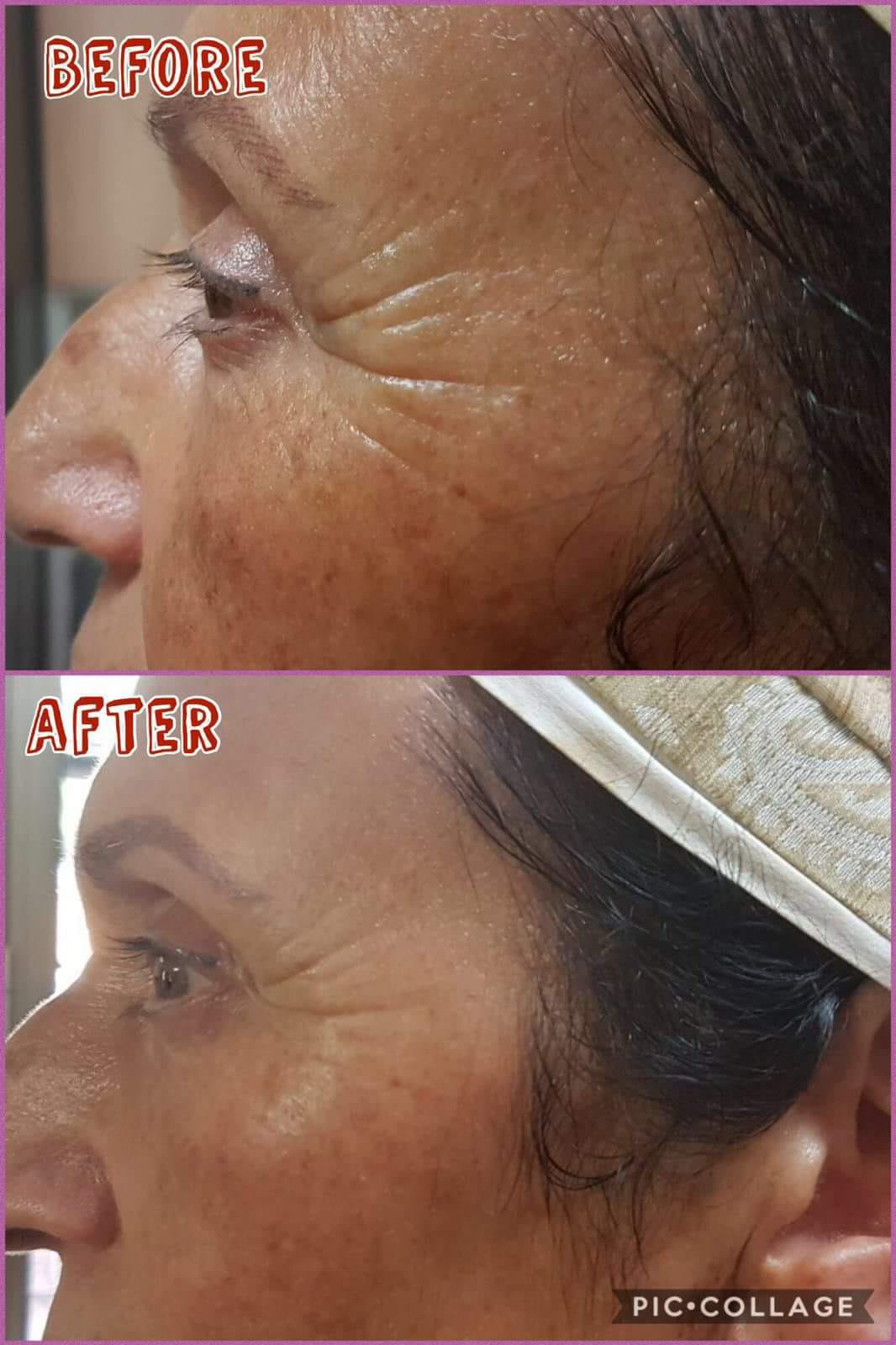 Wrinkle-reducing effect
