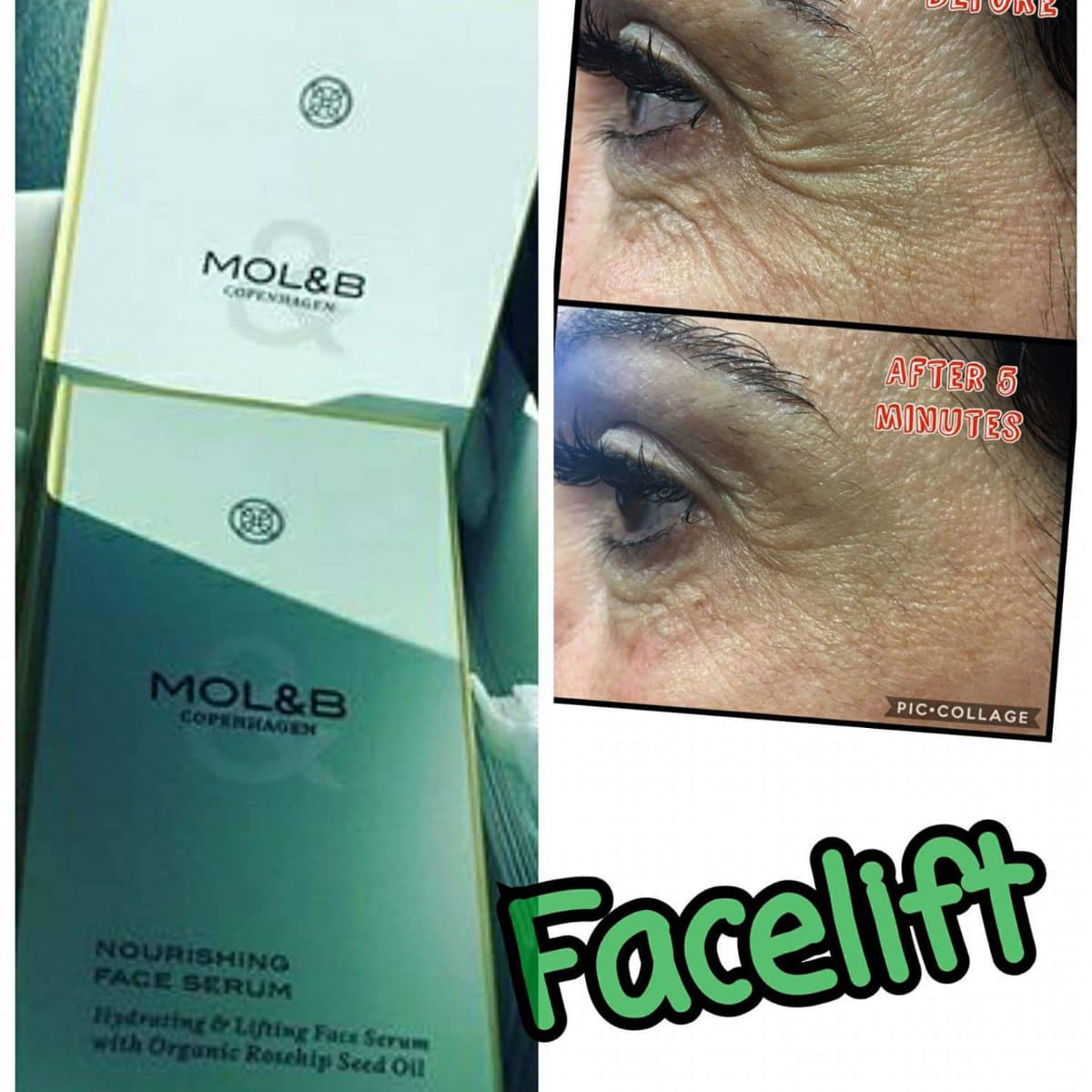 Wrinkle-reducing effect
