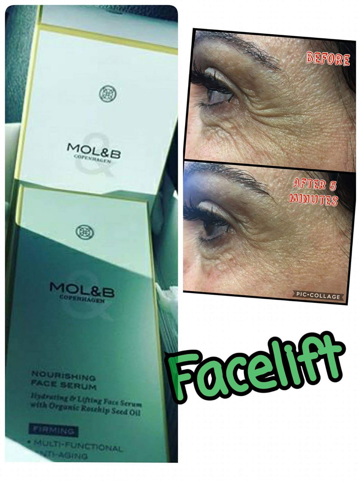 Wrinkle-reducing effect