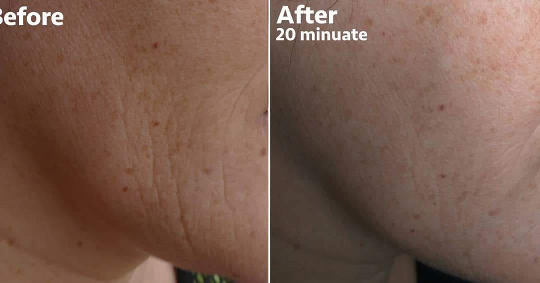 Wrinkle-reducing effect