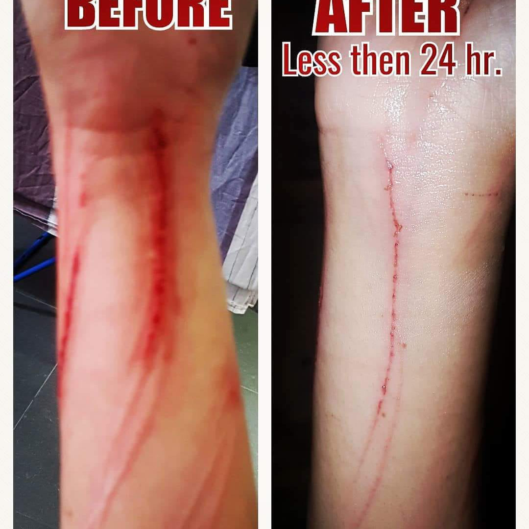Healing effect on wounds and scratches