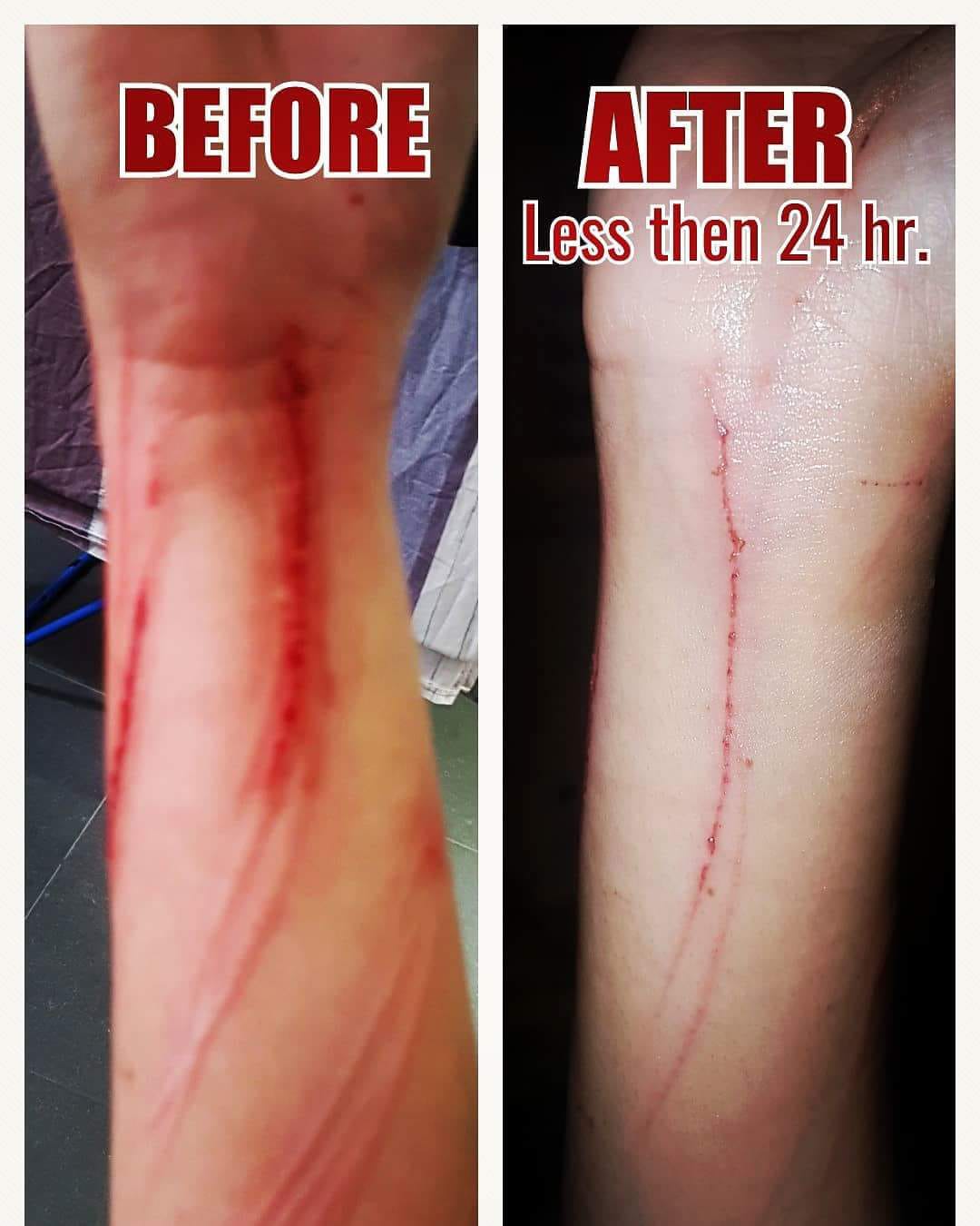 Healing effect on wounds and scratches